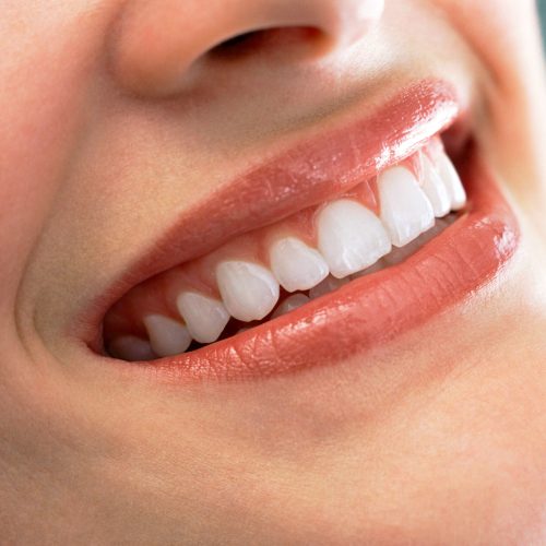 a-closeup-shot-of-a-smiling-woman-showing-her-clea-2026-03-26-05-33-05-utc